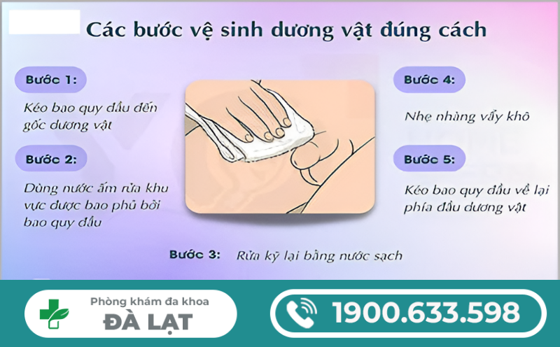 Hình ảnh minh họa